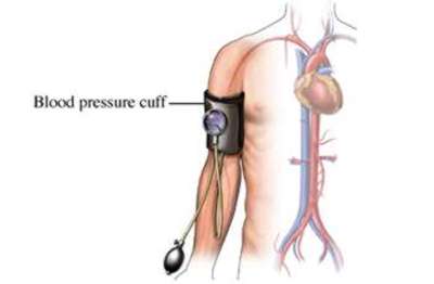 monitoring blood pressure
